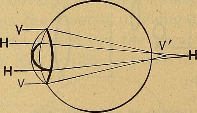 Reading Glasses for Astigmatism